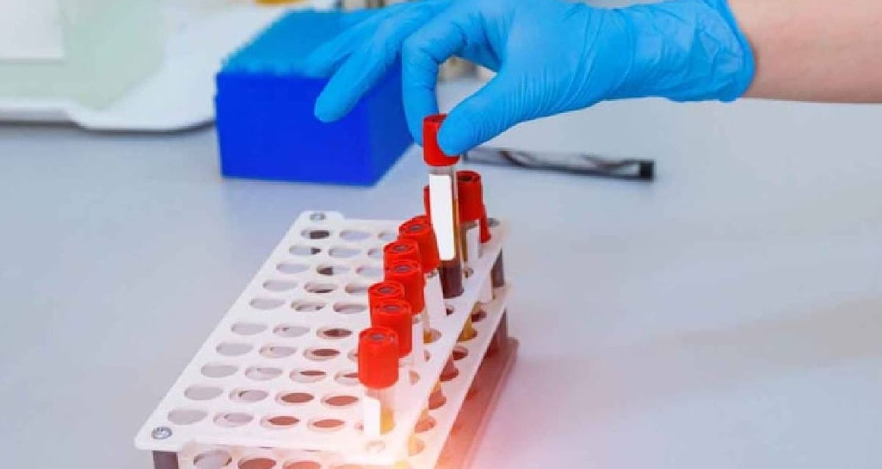 gribe an az yakalanan kan grubu belli oldu tNVckgc6